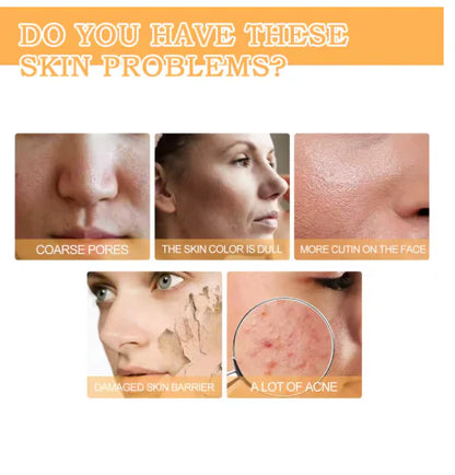 Eelhoe - Glycolic Acid 7% Toning Solution